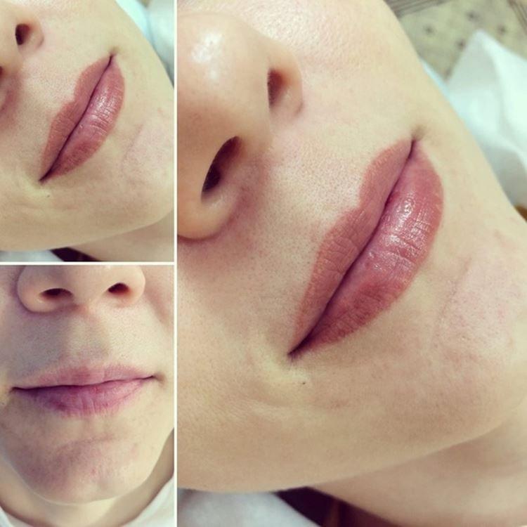 Maquillage permanent des lèvres - photos avant et après