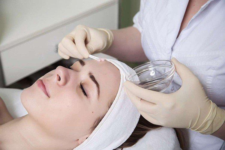 Peeling superficiel du visage