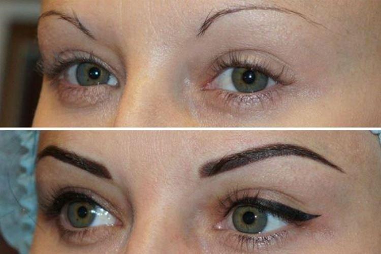 Tatouage des yeux - photos avant et après